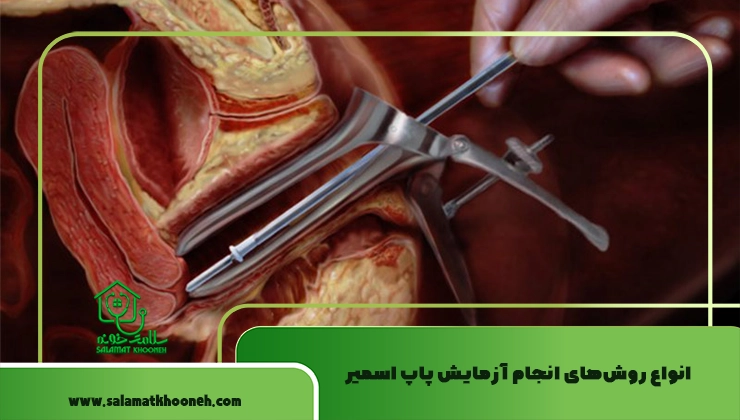 انواع روش‌های انجام آزمایش پاپ اسمیر