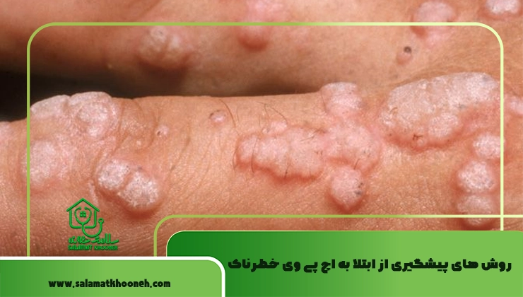روش های پیشگیری از ابتلا به اچ پی وی خطرناک