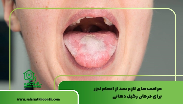 مراقبت‌های لازم بعد از انجام لیزر برای درمان زگیل دهانی