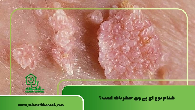 کدام نوع اچ پی وی خطرناک است؟