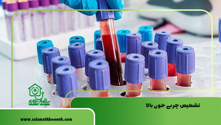 آزمایش چربی خون