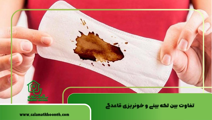 تفاوت بین لکه بینی و خونریزی قاعدگی
