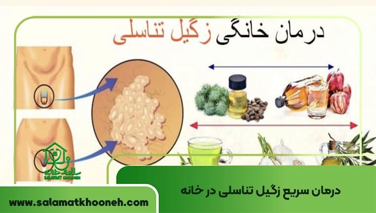 درمان سریع زگیل تناسلی