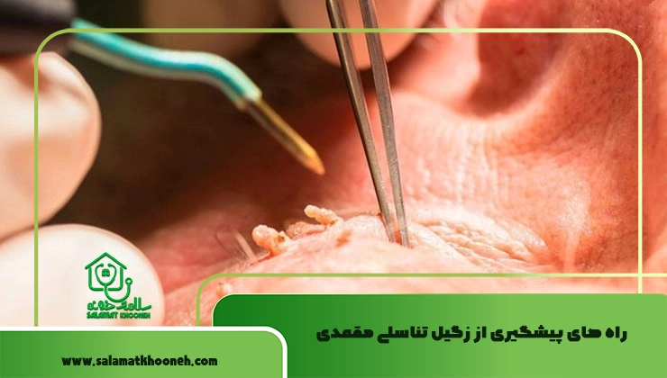 راه های پیشگیری از زگیل تناسلی مقعدی