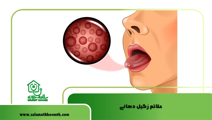 علائم زگیل دهانی