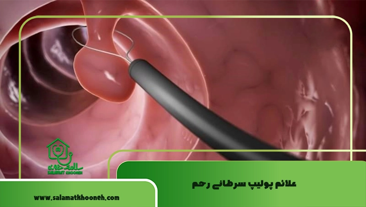 علائم پولیپ سرطانی رحم