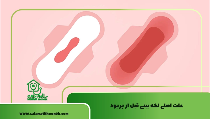 علت لکه بینی قبل قاعدگی