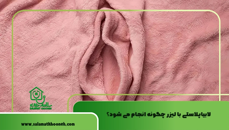 لابیاپلاستی با لیزر