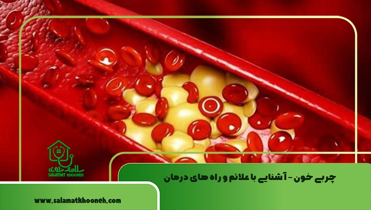 چربی خون