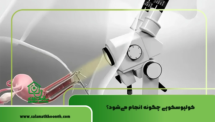 کولپوسکوپی چگونه انجام می‌شود؟