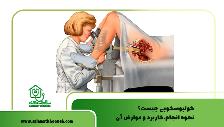 کولپوسکوپی چیست