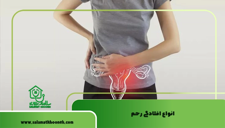 انواع افتادگی رحم