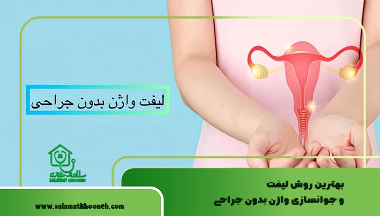 لیفت واژن بدون جراحی