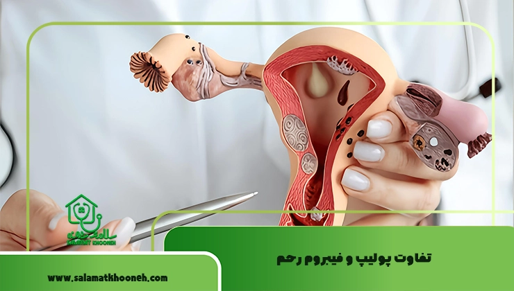 تفاوت پولیپ و فیبروم رحم