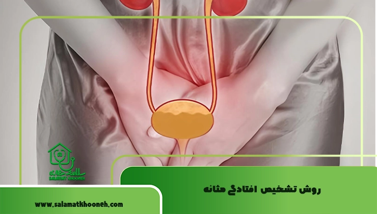 روش تشخیص افتادگی مثانه
