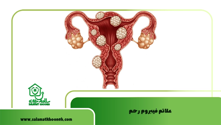 علائم فیبروم رحم