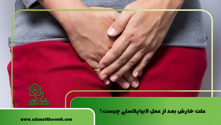 علل خارش بعد از عمل لابیاپلاستی