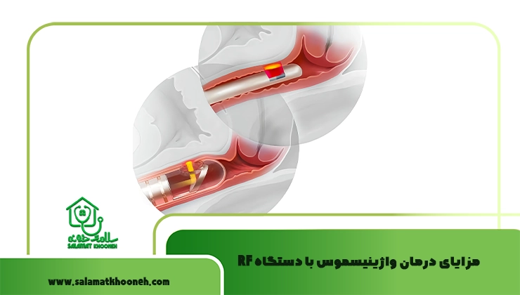 مزایای درمان واژینیسموس با دستگاه RF