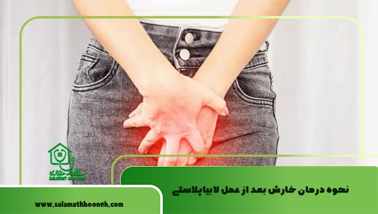درمان خارش بعد از عمل لابیاپلاستی