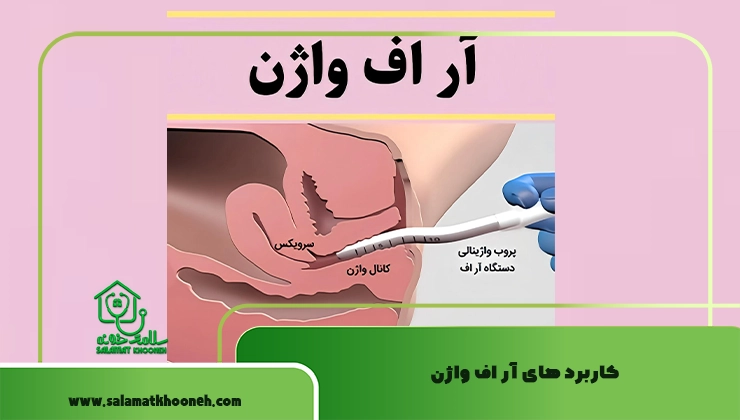 کاربرد آر اف واژن