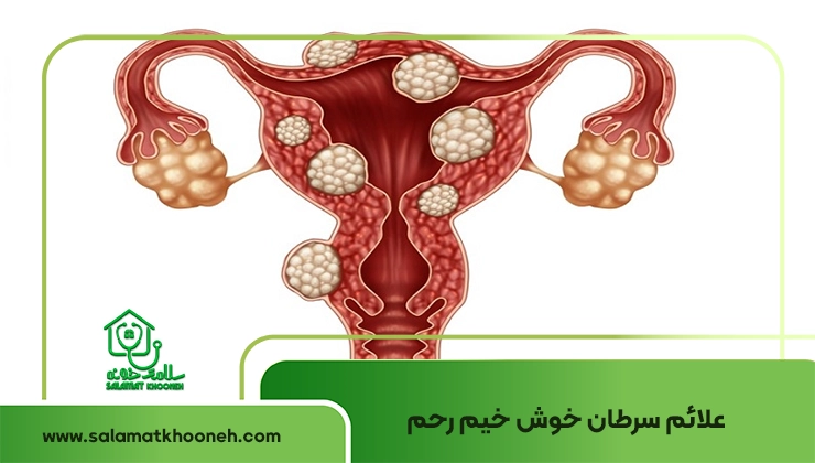 علائم سرطان خوش خیم رحم