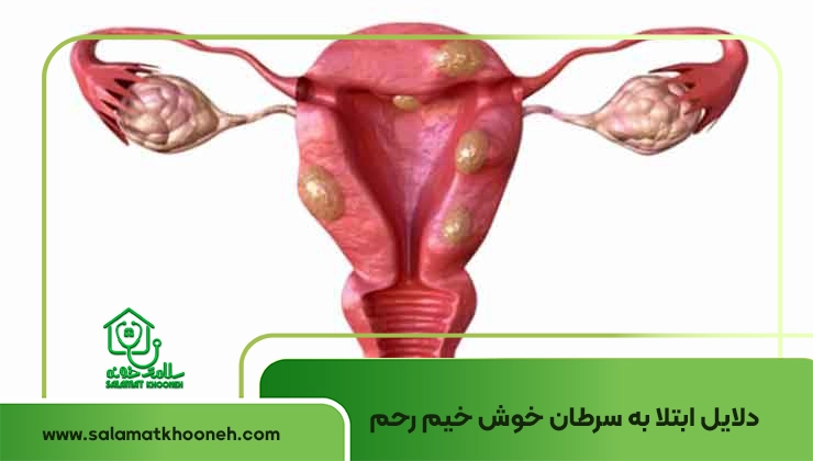 دلایل سرطان خوش خیم رحم