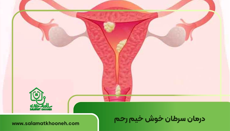 Benign uterine cancer
