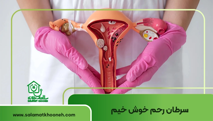 سرطان رحم خوش خیم