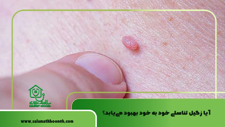 آیا زگیل تناسلی خود به‌ خود بهبود می‌یابد؟