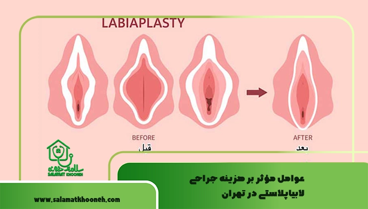 عوامل مؤثر بر هزینه