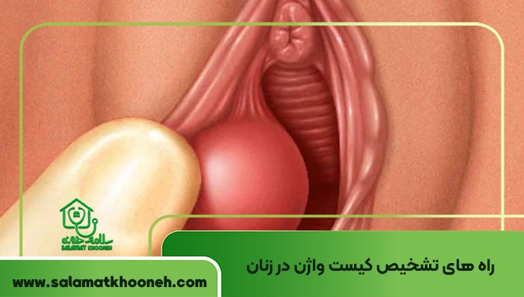 تشخیص کیست واژن