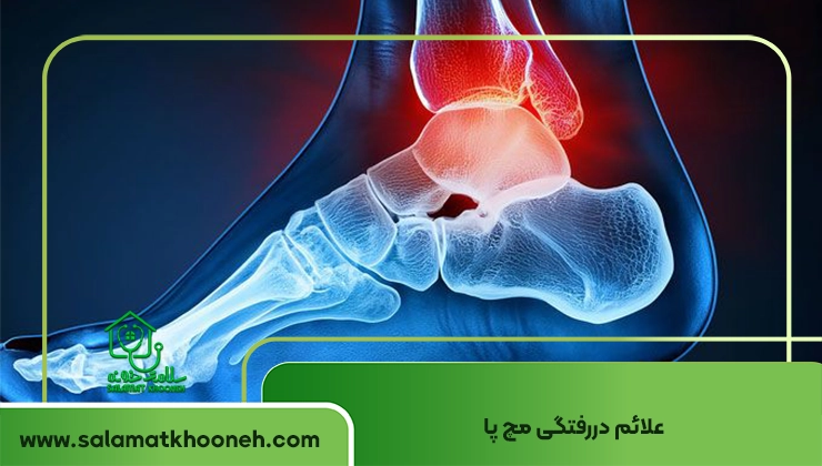 علائم دررفتگی مچ پا