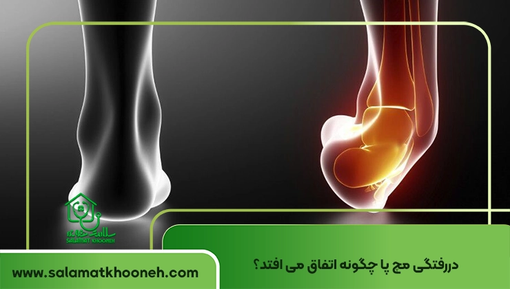 Ankle dislocation