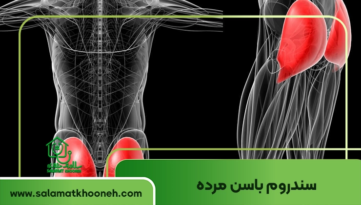 سندروم باسن مرده