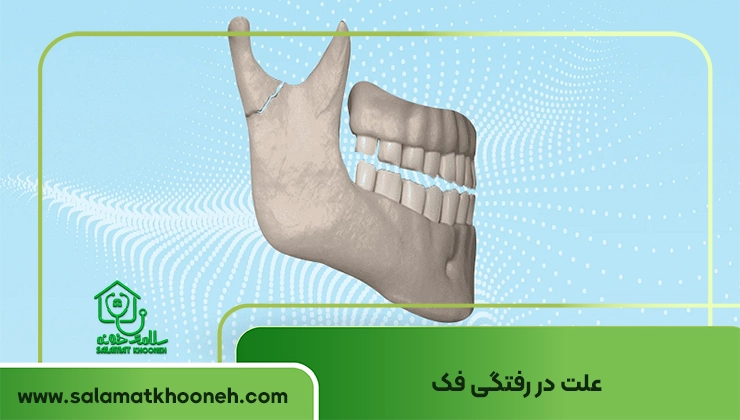 علت دررفتگی فک
