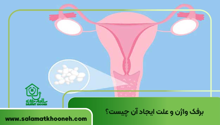 برفک واژن