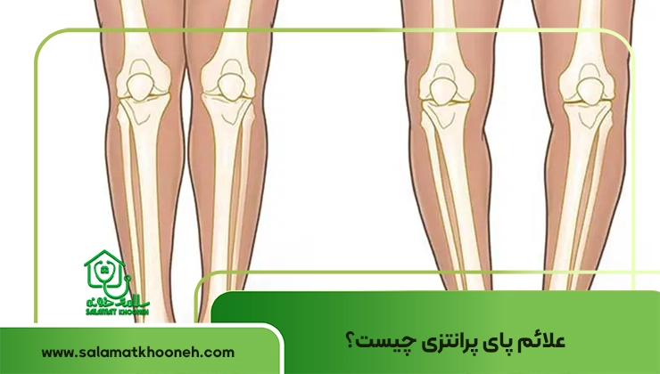 علائم پای پرانتز