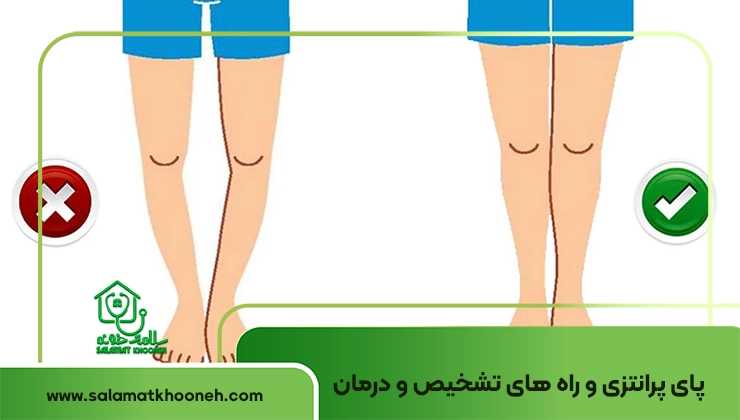 پای پرانتز