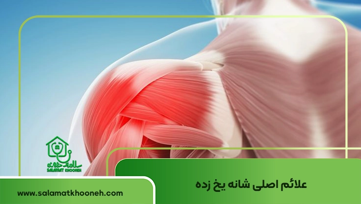 علائم شانه یخ زده