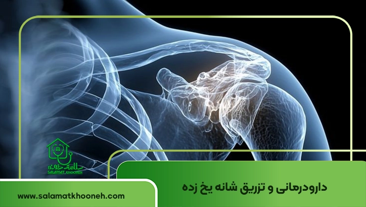 دارودرمانی شانه یخ زده