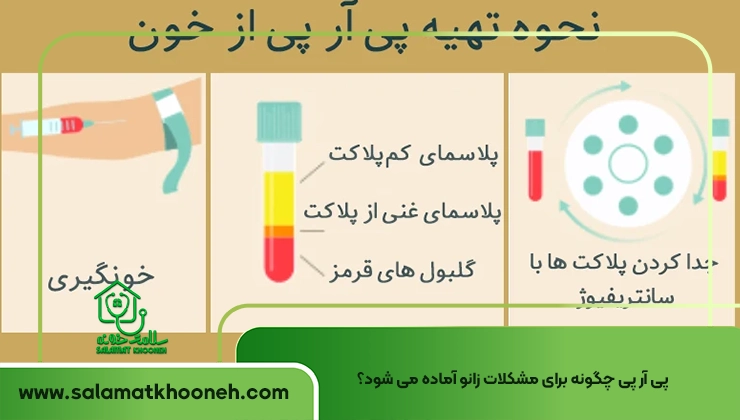 knee prp