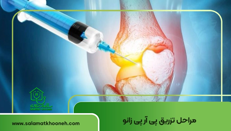 تزریق پی ار پی زانو