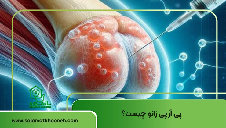 پی ار پی زانو