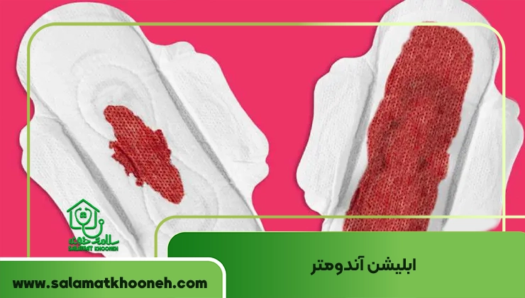 درمان خانگی زیاد شدن خون قاعدگی