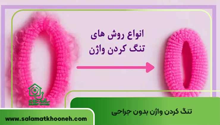 تنگ کردن واژن بدون جراحی