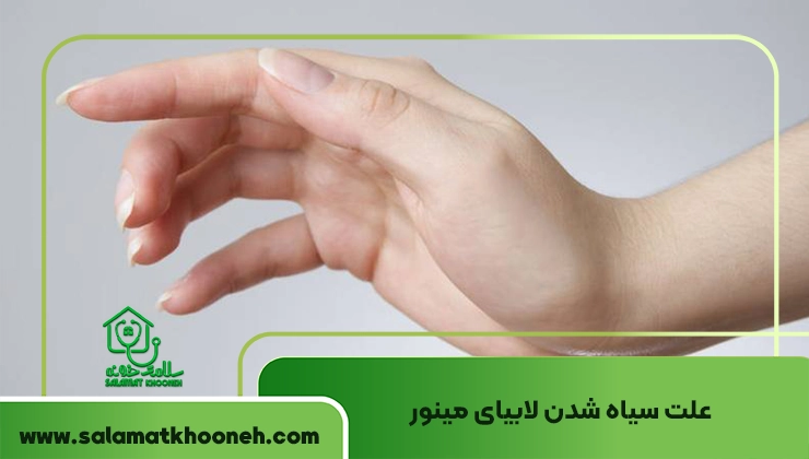 علت سیاه شدن لابیای مینور