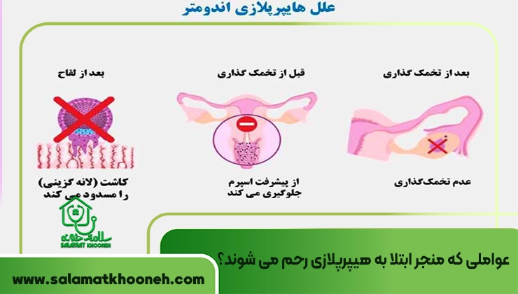 عواملی که منجر ابتلا به هیپرپلازی رحم می شوند؟
