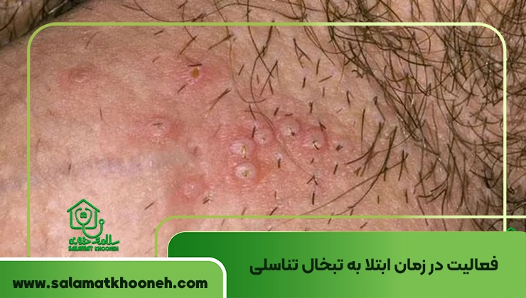 طول درمان تبخال تناسلی