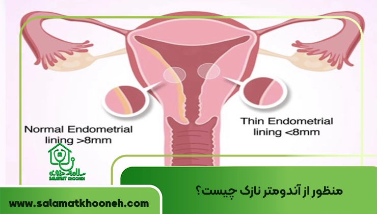 منظور از آندومتر نازک چیست؟