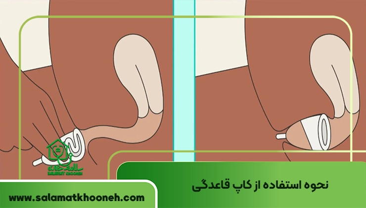 نحوه استفاده از کاپ قاعدگی